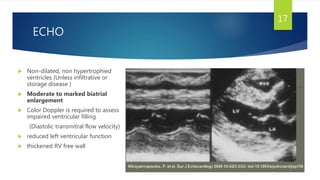 ECHO
 Non-dilated, non hypertrophied
ventricles (Unless infiltrative or
storage disease )
 Moderate to marked biatrial
enlargement
 Color Doppler is required to assess
impaired ventricular filling
(Diastolic transmitral flow velocity)
 reduced left ventricular function
 thickened RV free wall
17
 