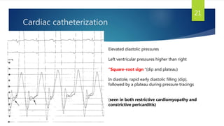 Cardiac catheterization
21
Elevated diastolic pressures
Left ventricular pressures higher than right
“Square-root sign “(dip and plateau)
In diastole, rapid early diastolic filling (dip),
followed by a plateau during pressure tracings
(seen in both restrictive cardiomyopathy and
constrictive pericarditis)
 