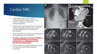 Cardiac MRI
 High diagnostic accuracy for
constrictive pericarditis, which can
present similar to restrictive
cardiomyopathy
 Important to distinguish from restrictive
cardiomyopathy as definitive surgical
therapy available for constrictive
pericarditis
 Gold standard for noninvasive diagnosis
of cardiac hemochromatosis.
 Cardiac magnetic resonance (CMR) is
a versatile technique providing
anatomical, morphological and
functional information.
 found useful to guide treatment, assess
its outcome and predict patient
prognosis
30
 
