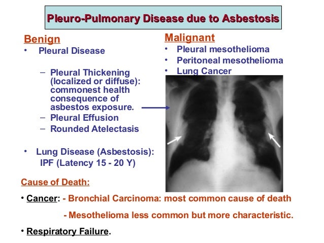 4 Restrictive Lung Diseases
