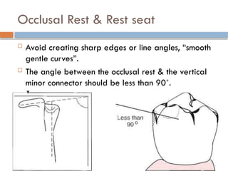 Occlusal Rest & Rest seat
 Avoid creating sharp edges or line angles, “smooth
gentle curves”.
 The angle between the occlusal rest & the vertical
minor connector should be less than 90˚.
 