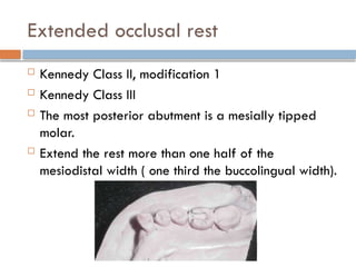 Extended occlusal rest
 Kennedy Class II, modification 1
 Kennedy Class III
 The most posterior abutment is a mesially tipped
molar.
 Extend the rest more than one half of the
mesiodistal width ( one third the buccolingual width).
 