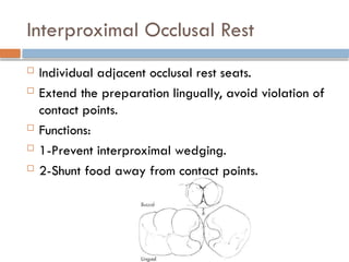 Interproximal Occlusal Rest
 Individual adjacent occlusal rest seats.
 Extend the preparation lingually, avoid violation of
contact points.
 Functions:
 1-Prevent interproximal wedging.
 2-Shunt food away from contact points.
 