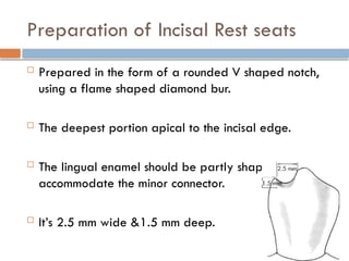 Preparation of Incisal Rest seats
 Prepared in the form of a rounded V shaped notch,
using a flame shaped diamond bur.
 The deepest portion apical to the incisal edge.
 The lingual enamel should be partly shaped to
accommodate the minor connector.
 It’s 2.5 mm wide &1.5 mm deep.
 