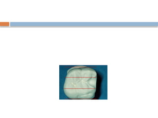 Rests & Rest Seats.pptx removable partial