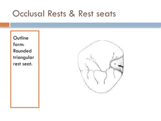 Occlusal Rests & Rest seats
Outline
form:
Rounded
triangular
rest seat.
 