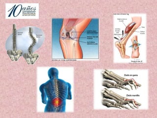 PERSONAS CON MOLESTIAsi presentano presenta31.90%68.10%Encuesta realizada  en abril del 2011, en las calles de San Luis Potosí