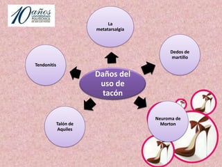 El calzado de tacón alto es “un calzado que se caracteriza por elevar el talón sobre la   altura de los dedos de los pies. El efecto de este tipo de calzado es el de aparentar unas piernas más largas”.