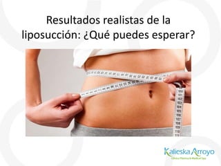 Resultados realistas de la
liposucción: ¿Qué puedes esperar?
 