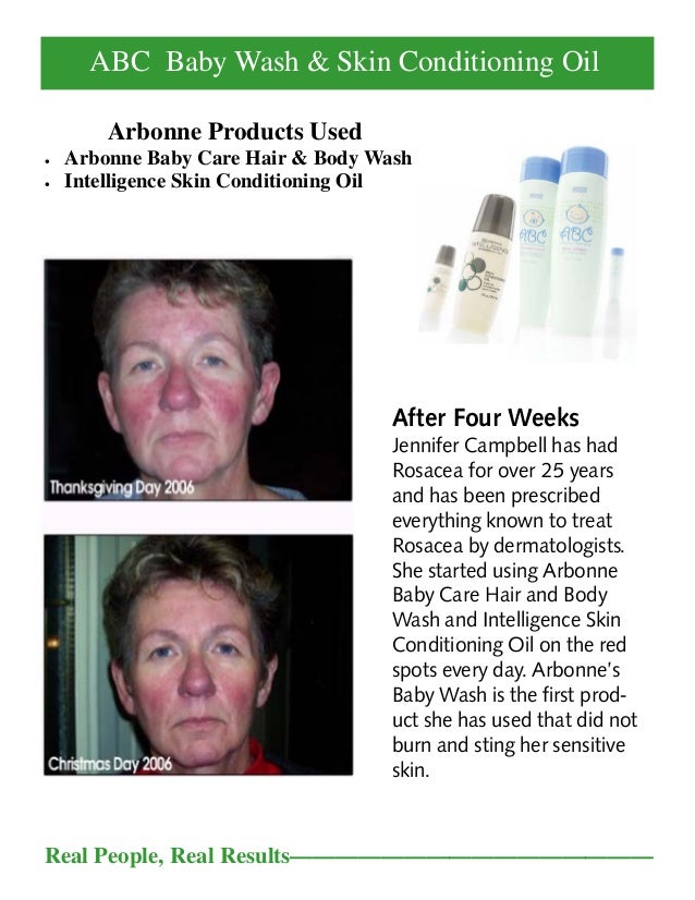 arbonne rosacea