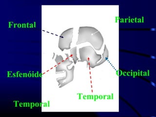 Parietal
Frontal




Esfenóide              Occipital

            Temporal
 Temporal
 