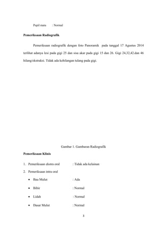 Pupil mata : Normal
Pemeriksaan Radiografik
Pemeriksaan radiografik dengan foto Panoramik pada tanggal 17 Agustus 2014
terlihat adanya lesi pada gigi 25 dan sisa akar pada gigi 15 dan 26. Gigi 24,32,42.dan 46
hilang/ekstraksi. Tidak ada kehilangan tulang pada gigi.
Gambar 1. Gambaran Radiografik
Pemeriksaan Klinis
1. Pemeriksaan ekstra oral : Tidak ada kelainan
2. Pemeriksaan intra oral
• Bau Mulut : Ada
• Bibir : Normal
• Lidah : Normal
• Dasar Mulut : Normal
3
 
