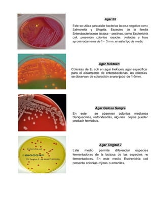 Agar SS
Este se utiliza para aislar bacterias lactosa negativa como
Salmonella y Shigella. Especies de la familia
Enterobacteriaceae lactosa – positivas, como Escherichia
coli, presentan colonias rosadas, ovaladas y lisas
aproximadamente de 1 - 3 mm. en este tipo de medio
Agar Hektoen
Colonias de E. coli en agar Hektoen, agar específico
para el aislamiento de enterobacterias, las colonias
se observan de coloración anaranjado de 1-5mm.
Agar Gelosa Sangre
En este se observan colonias medianas
blanquecinas, redondeadas, algunas cepas pueden
producir hemólisis.
Agar Tergitol 7
Este medio permite diferenciar especies
fermentadoras de la lactosa de las especies no
fermentadoras. En este medio Escherichia coli
presenta colonias rojizas o amarillas.
 