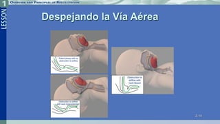 2-14
Despejando la Vía Aérea
 