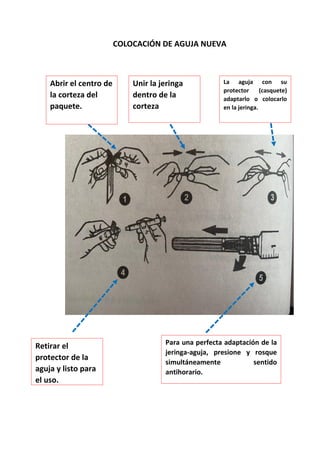COLOCACIÓN DE AGUJA NUEVA
Abrir el centro de
la corteza del
paquete.
Unir la jeringa
dentro de la
corteza
La aguja con su
protector (casquete)
adaptarlo o colocarlo
en la jeringa.
Retirar el
protector de la
aguja y listo para
el uso.
Para una perfecta adaptación de la
jeringa-aguja, presione y rosque
simultáneamente sentido
antihorario.
 
