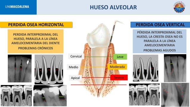 Periodoncia clinica de lindhe