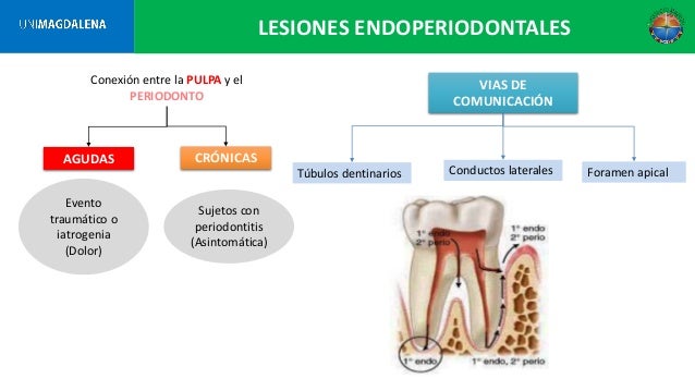 Periodoncia clinica de lindhe