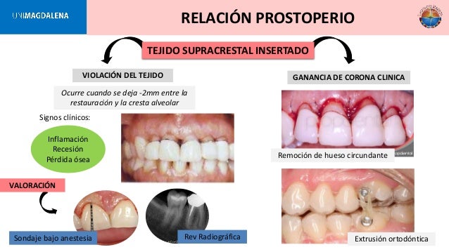 Periodoncia clinica de lindhe