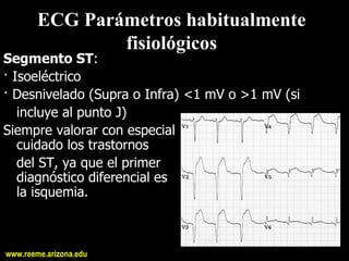 ECG Parámetros habitualmente 
                fisiológicos 
Segmento ST: 
· Isoeléctrico 
· Desnivelado (Supra o Infra) <1 mV o >1 mV (si 
   incluye al punto J) 
Siempre valorar con especial 
   cuidado los trastornos 
   del ST, ya que el primer 
   diagnóstico diferencial es 
   la isquemia.



www.reeme.arizona.edu
 