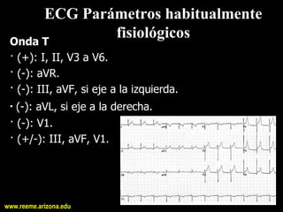 ECG Parámetros habitualmente 
 Onda T 
              fisiológicos 
 · (+): I, II, V3 a V6. 
 · (­): aVR. 
 · (­): III, aVF, si eje a la izquierda. 
 ∙ (­): aVL, si eje a la derecha. 
 · (­): V1. 
 · (+/­): III, aVF, V1.




www.reeme.arizona.edu
 