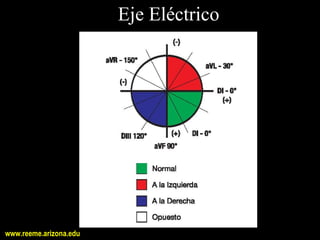 Eje Eléctrico




www.reeme.arizona.edu
 