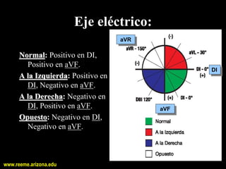 Eje eléctrico: 
                                     aVR 
                                      aVR 

      Normal: Positivo en DI, 
      Normal 
        Positivo en aVF. 
                                                     DI 
                                                     DI 
      A la Izquierda: Positivo en 
           Izquierda 
        DI, Negativo en aVF. 
      A la Derecha: Negativo en 
           Derecha 
        DI, Positivo en aVF.                 aVF
                                              aVF 
      Opuesto: Negativo en DI, 
      Opuesto 
        Negativo en aVF. 



www.reeme.arizona.edu
 