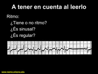 A tener en cuenta al leerlo 
    Ritmo: 
      ¿Tiene o no ritmo? 
      ¿És sinusal? 
      ¿És regular?




www.reeme.arizona.edu
 