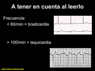 A tener en cuenta al leerlo 
 Frecuencia: 
   < 60/min = bradicardia 



     > 100/min = taquicardia




www.reeme.arizona.edu
 
