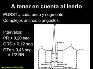 A tener en cuenta al leerlo 
 PQRSTU cada onda y segmento. 
 Complejos anchos o angostos. 

 Intervalos: 
 PR < 0,20 seg 
 QRS < 0,12 seg 
 QTc < 0,43 seg, 
    ó 1/2 RR

www.reeme.arizona.edu
 