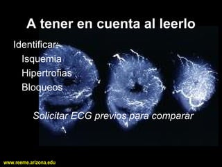A tener en cuenta al leerlo 
   Identificar: 
     Isquemia 
     Hipertrofias 
     Bloqueos 

           Solicitar ECG previos para comparar



www.reeme.arizona.edu
 