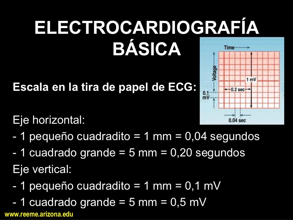 resumen-ekg-ppt