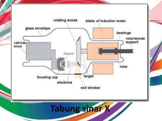 Tabung sinar X
 