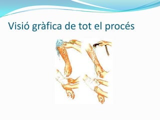 Visió gràfica de tot el procés