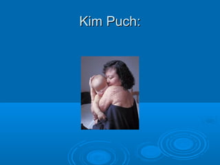 Kim Puch:
 