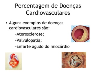 Percentagem de Doenças
        Cardiovasculares
• Alguns exemplos de doenças
  cardiovasculares são:
     -Aterosclerose;
     -Valvulopatia;
     -Enfarte agudo do miocárdio
 