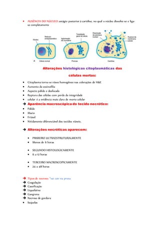  AUSÊNCIA DO NÚCLEO: estágio posterior à cariólise, no qual o núcleo dissolve-se e liga-
se completamente
Alterações histológicas citoplasmáticas das
células mortas:
 Citoplasma torna-se róseo homogêneo nas colorações de H&E
 Aumento da eosinofilia
 Aspecto pálido e desfocado
 Ruptura das células com perda da integridade
 celular é a evidência mais clara de morte celular
 Aparência macroscópica do tecido necrótico:
 Pálido
 Macio
 Friável
 Nitidamente diferenciável dos tecidos viáveis.
 Alterações necróticas aparecem:
 PRIMEIRO ULTRAESTRUTURALMENTE
 Menos de 6 horas
 SEGUNDO HISTOLOGICAMENTE
 6 a 12 horas
 TERCEIRO MACROSCOPICAMENTE
 24 a 48 horas
 Tipos de necrose: *vai cair na prova
 Coagulação
 Caseificação
 Liquefativa
 Gangrena
 Necrose de gordura
 Sequelas
 