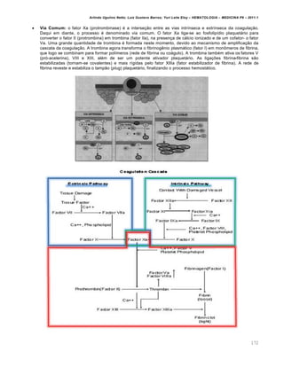 Arlindo Ugulino Netto; Luiz Gustavo Barros; Yuri Leite Eloy – HEMATOLOGIA – MEDICINA P8 – 2011.1
172
 Via Comum: o fator Xa (protrombinase) é a interseção entre as vias intrínseca e extrínseca da coagulação.
Daqui em diante, o processo é denominado via comum. O fator Xa liga-se ao fosfolipídio plaquetário para
converter o fator II (protrombina) em trombina (fator IIa), na presença de cálcio ionizado e de um cofator- o fator
Va. Uma grande quantidade de trombina é formada neste momento, devido ao mecanismo de amplificação da
cascata da coagulação. A trombina agora transforma o fibrinogênio plasmático (fator I) em monômeros de fibrina,
que logo se combinam para formar polímeros (rede de fibrina ou coágulo). A trombina também ativa os fatores V
(pró-acelerina), VIII e XIII, além de ser um potente ativador plaquetário. As ligações fibrina-fibrina são
estabilizadas (tornam-se covalentes) e mais rígidas pelo fator XlIIa (fator estabilizador de fibrina). A rede de
fibrina reveste e estabiliza o tampão (plug) plaquetário, finalizando o processo hemostático.
 