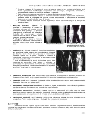 Arlindo Ugulino Netto; Luiz Gustavo Barros; Yuri Leite Eloy – HEMATOLOGIA – MEDICINA P8 – 2011.1
190
 Antes da instala•‚o da hemartrose, ƒ comum o paciente passar por um per†odo semelhante a uma
“aura”, apresentando manifesta•…es inespec†ficas como inqueta•‚o, formigamento, ansiedade e,
posteriormente, aumento da articula•‚o acometida e calor local.
 Ap€s tratamento cessa o sangramento, porƒm a absor•‚o total do sangue n‚o ocorre
 Surgem rea•…es inflamat€rias cr’nicas na membrana sinovial que se torna espessada e vascularizada,
formando dobras e vilosidades que propicia a novos sangramentos. O sangramento ƒ decorrente
justamente por rompimento dos vasos da sin€via.
 A cartilagem articular evolui com eros…es, degenera•‚o fibrilar, crescimento irregular e altera•‚o da
forma•‚o €ssea.
 Artropatia hemofílica crônica: sua
gravidade ƒ proporcional ao nˆmero de
hemartrose ocorridas, pois consiste em uma
complica•‚o desta patologia. As principais
caracter†sticas da artropatia s‚o a perda ou
limita•‚o da movimenta•‚o articular,
contratura fixa em flex‚o e intensa atrofia
muscular, secund„ria ao desuso.
A radiografia simples ƒ capaz de mostrar a
destrui•‚o da articula•‚o, caracterizando a
artropatia cr’nica, como mostra a figura ao
lado.
 Hematomas: ƒ a segunda causa mais comum de sangramento
em hemof†licos graves, podendo ser espont‹neos ou causados
por traumas leves. Podem ser pequenos e autolimitados,
causando apenas dor, a graves, chegando a dissecar a
musculatura, resultando em compress‚o de estruturas nobres
(s†ndrome compartimental).
O local do sangramento se d„ na musculatura, sendo mais
frequentes em panturrilha, coxa, glˆteos e antebra•o. A
complica•‚o mais comum destes hematomas ƒ o surgimento da
s†ndrome compartimental, com aumento da press‚o no segmento
envolvido e compress‚o de vasos e nervos.
 Hematomas do ileopsoas: pode ser confundida com apendicite aguda (quando o hematoma se instala no
ileopsoas do lado direito), sendo necess„rio solicitar USG abdominal para esclarecimento diagn€stico.
 Hematúria: ocorre em 2/3 dos casos. ‡ prudente solicitar exames como urina I e USG renal (para estabelecer
diagn€stico diferencial com c„lculo renal).
 Sangramento gastrointestinal: hematŽmese ou melena. A origem, na maioria dos casos, se d„ por gastrite ou
por ˆlceras g„stricas. Entretanto, ƒ uma condi•‚o n‚o muito frequente.
 Sangramento intracraniano: hematoma subdural, epidural ou intracerebral que pode surgir de forma
espont‹nea ou ap€s traumas. Em pacientes hemof†licos, podemos sugerir um sangramento intracraniano na
presen•a de cefalƒia duradoura (por mais de 4 horas), tontura, perda da consciŽncia, etc.
 Pseudotumor hemofílico: pouco frequente, porƒm grave. Hematoma persiste em forma de les‚o c†stica
encapsulada. Podem causar compress‚o e destrui•‚o dos mˆsculos, nervos e ossos.
DIAGNÓSTICO
O diagn€stico deve ser sugerido logo que uma crian•a apresenta sangramentos anormais durante atividades
rotineiras, principalmente em mucosas, articula•…es e hematomas em grupos musculares. Alƒm disso, ƒ comum relatos
familiares de hemofilia.
 