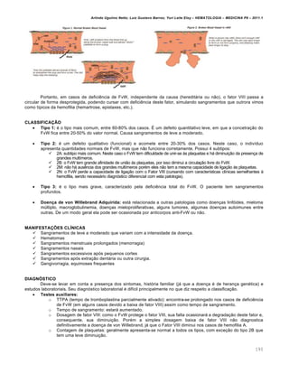 Arlindo Ugulino Netto; Luiz Gustavo Barros; Yuri Leite Eloy – HEMATOLOGIA – MEDICINA P8 – 2011.1
193
Portanto, em casos de deficiência de FvW, independente da causa (hereditária ou não), o fator VIII passa a
circular de forma desprotegida, podendo cursar com deficiência deste fator, simulando sangramentos que outrora vimos
como típicos da hemofilia (hemartrose, epistaxes, etc.).
CLASSIFICAÇÃO
 Tipo 1: é o tipo mais comum, entre 60-80% dos casos. É um defeito quantitativo leve, em que a concetração do
FvW fica entre 20-50% do valor normal. Causa sangramentos de leve a moderado.
 Tipo 2: é um defeito qualitativo (funcional) e acomete entre 20-30% dos casos. Neste caso, o indivíduo
apresenta quantidades normais de FvW, mas que não funciona corretamente. Possui 4 subtipos:
 2A: subtipo mais comum. Neste caso o FvW tem dificuldade de unir-se às plaquetas e há diminuição da presença de
grandes multímeros.
 2B: o FvW tem grande afinidade de união às plaquetas, por isso diminui a circulação livre do FvW.
 2M: não há ausência dos grandes multímeros porém eles não tem a mesma capacidade de ligação às plaquetas.
 2N: o FvW perde a capacidade de ligação com o Fator VIII (cursando com características clínicas semelhantes à
hemofilia, sendo necessário diagnóstico diferencial com esta patologia).
 Tipo 3: é o tipo mais grave, caracterizado pela deficiência total do FvW. O paciente tem sangramentos
profundos.
 Doença de von Willebrand Adquirida: está relacionada a outras patologias como doenças linfóides, mieloma
múltiplo, macroglobulinemia, doenças mieloproliferativas, alguns tumores, algumas doenças autoimunes entre
outras. De um modo geral ela pode ser ocasionada por anticorpos anti-FvW ou não.
MANIFESTAÇÕES CLÍNICAS
 Sangramentos de leve a moderado que variam com a intensidade da doença.
 Hematomas
 Sangramentos menstruais prolongados (menorragia)
 Sangramentos nasais
 Sangramentos excessivos após pequenos cortes
 Sangramentos após extração dentária ou outra cirurgia.
 Gengivorragia, equimoses frequentes
DIAGNÓSTICO
Deve-se levar em conta a presença dos sintomas, história familiar (já que a doença é de herança genética) e
estudos laboratoriais. Seu diagnóstico laboratorial é difícil principalmente no que diz respeito a classificação.
 Testes auxiliares:
o TTPA (tempo de tromboplastina parcialmente ativado): encontra-se prolongado nos casos de deficiência
de FvW (em alguns casos devido a baixa de fator VIII) assim como tempo de sangramento.
o Tempo de sangramento: estará aumentado.
o Dosagem de fator VIII: como o FvW protege o fator VIII, sua falta ocasionará a degradação deste fator e,
consequente, sua diminuição. Porém a simples dosagem baixa de fator VIII não diagnostica
definitivamente a doença de von Willebrand, já que o Fator VIII diminui nos casos de hemofilia A.
o Contagem de plaquetas: geralmente apresenta-se normal a todos os tipos, com exceção do tipo 2B que
tem uma leve diminuição.
 