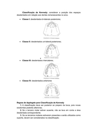 Classificação de Kennedy: considerar a posição dos espaços
desdentados em relação aos dentes remanescentes no arco.
 Classe I: desdentados bi-laterais posteriores;
 Classe II: desdentados uni-lateral posteriores;

 Classe III: desdentados intercalares;
 Classe IV: desdentados anteriores
Regras de Applegate para Classificação de Kennedy
1. A classificação deve ser posterior ao preparo da boca, pois novas
exodontias poderão alterá-las;
2. Se o terceiro molar estiver ausente, não se leva em conta a área
desdentada correspondente;
3. Se os terceiros molares estiverem presentes e serão utilizados como
suporte, devem ser considerados na classificação;
 