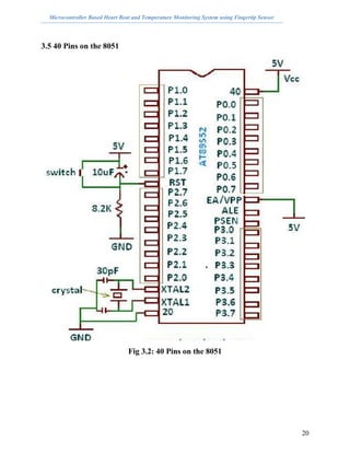 Microcontroller Based Heart Beat and Temperature Monitoring System using Fingertip Sensor
3.5 40 Pins on the 8051
Fig 3.2:...