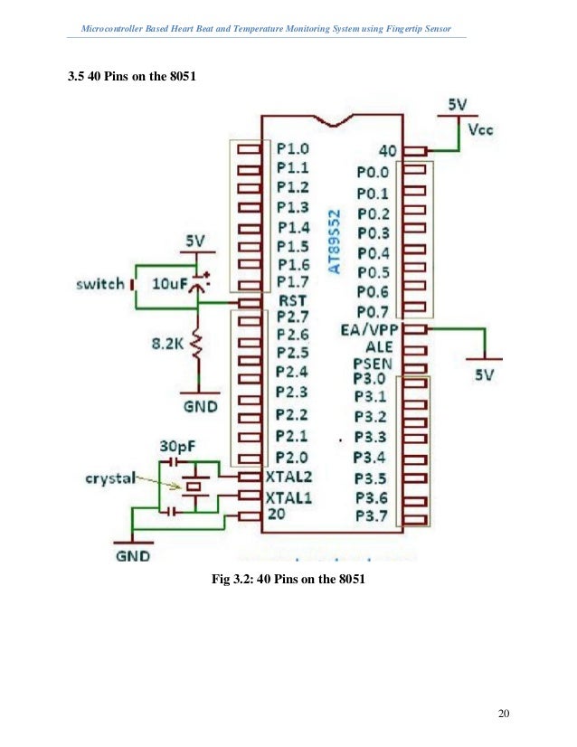 Microcontroller Based Heart Beat and Temperature Monitoring System us…