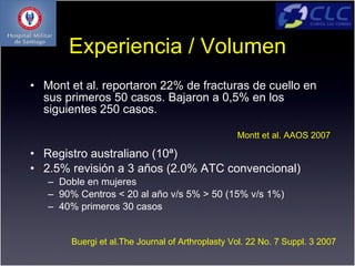 Experiencia / Volumen
• Mont et al. reportaron 22% de fracturas de cuello en
  sus primeros 50 casos. Bajaron a 0,5% en los
  siguientes 250 casos.

                                                 Montt et al. AAOS 2007

• Registro australiano (10ª)
• 2.5% revisión a 3 años (2.0% ATC convencional)
   – Doble en mujeres
   – 90% Centros < 20 al año v/s 5% > 50 (15% v/s 1%)
   – 40% primeros 30 casos


       Buergi et al.The Journal of Arthroplasty Vol. 22 No. 7 Suppl. 3 2007
 
