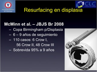 Resurfacing en displasia

McMinn et al. – JBJS Br 2008
  – Copa Birmingham p/Displasia
  – 6 – 9 años de seguimiento
  – 110 casos: 6 Crow I,
      56 Crow II, 48 Crow III
  – Sobrevida 95% a 9 años
 