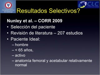 Resultados Selectivos?
Nunley et al. – CORR 2009
• Selección del paciente
• Revisión de literatura – 207 estudios
• Paciente Ideal:
  – hombre
  – < 65 años,
  – activo
  – anatomía femoral y acetabular relativamente
    normal
 