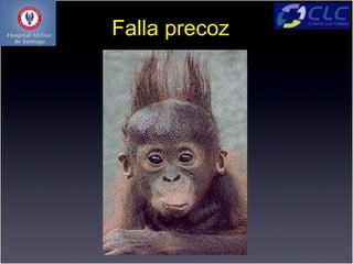 Falla precoz
 