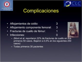 Complicaciones

•   Aflojamientos de cotilo:                    3
•   Aflojamiento componente femoral:            3
•   Fracturas de cuello de fémur:               1
•   Infecciones:                                0
    – (Mont et al. reportaron 22% de fracturas de cuello en sus
      primeros 50 casos. Bajaron a 0,5% en los siguientes 250
      casos)
    – Todas primeros 35 pacientes
 