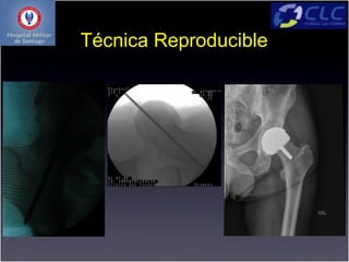 Técnica Reproducible
 