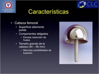 Características
• Cabeza femoral
  • Superficie altamente
    pulida
  • Componentes delgados
     • Escasa resección de
       hueso
  • Tamaño grande de la
    cabeza (40 – 56 mm)
     • Menores posibilidades de
       luxación
 