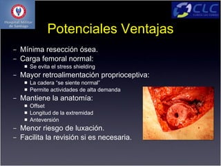 Potenciales Ventajas
–   Mínima resección ósea.
–   Carga femoral normal:
        Se evita el stress shielding
–   Mayor retroalimentación proprioceptiva:
        La cadera “se siente normal”
        Permite actividades de alta demanda
–   Mantiene la anatomía:
        Offset
        Longitud de la extremidad
        Anteversión
–   Menor riesgo de luxación.
–   Facilita la revisión si es necesaria.
 